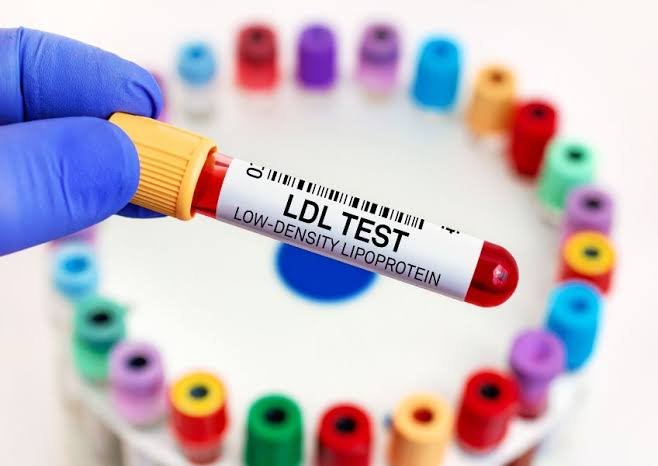 Alimentos que ajudam a controlar o colesterol